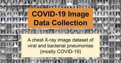 COVID-19 Image Data Collection: Prospective Predictions are the Future cover file