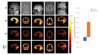A Heteroscedastic Uncertainty Model for Decoupling Sources of MRI Image Quality cover file