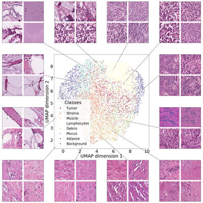 PathologyGAN: Learning deep representations of cancer tissue cover file