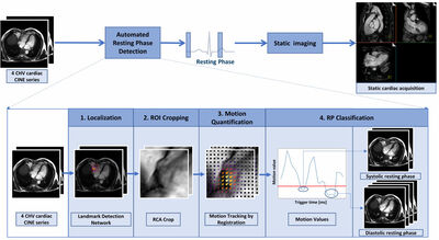 Automated Cardiac Resting Phase Detection Targeted on the Right Coronary Artery cover file