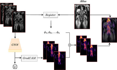 Atlas-Based Interpretable Age Prediction In Whole-Body MR Images cover file