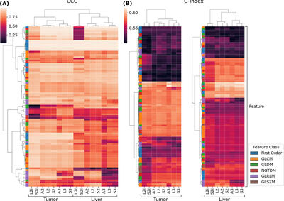 Finding Reproducible and Prognostic Radiomic Features in Variable Slice Thickness Contrast Enhanced CT of Colorectal Liver Metastases cover file