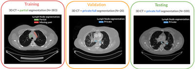 LNQ 2023 challenge: Benchmark of weakly-supervised techniques for mediastinal lymph node quantification cover file