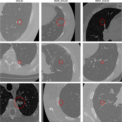Exploring Fairness and Performance Drivers Across State-of-the-Art Pulmonary Nodule Detection Algorithms cover file