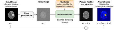 Denoising Diffusion Models for Anomaly Localization in Medical Images cover file
