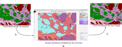 BoMBR: An Annotated Bone Marrow Biopsy Dataset for Segmentation of Reticulin Fibers cover file