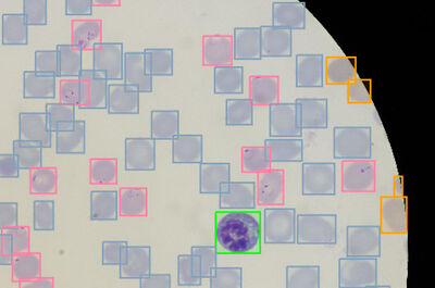 A COCO-Formatted Instance-Level Dataset for Plasmodium Falciparum Detection in Giemsa-Stained Blood Smears cover file