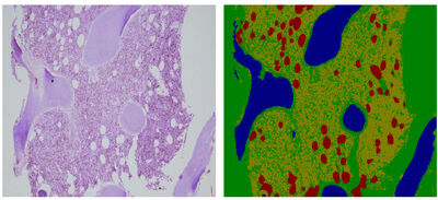 BaMBo: An Annotated Bone Marrow Biopsy Dataset for Segmentation Task cover file