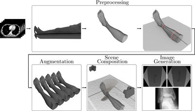 Patient Pose Assessment Using a CT-Based Framework for Synthetic Data Generation cover file
