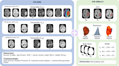 CFB-GBM v2.0: An Augmented Longitudinal Dataset for Multi-Modal Glioblastoma Segmentation, Radiomics, and RANO Progression Tracking cover file