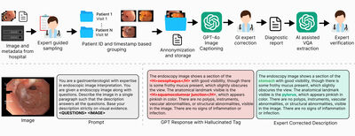 SAGE: An Expert-Annotated South Asian GI Endoscopy Dataset for Multimodal Learning and Hallucination Analysis cover file